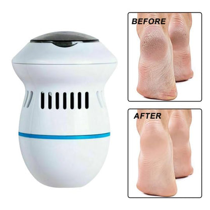 Round Electric Foot File Grinder