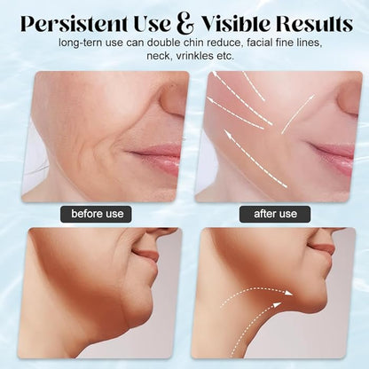 FACE&NECK FIT Pro™