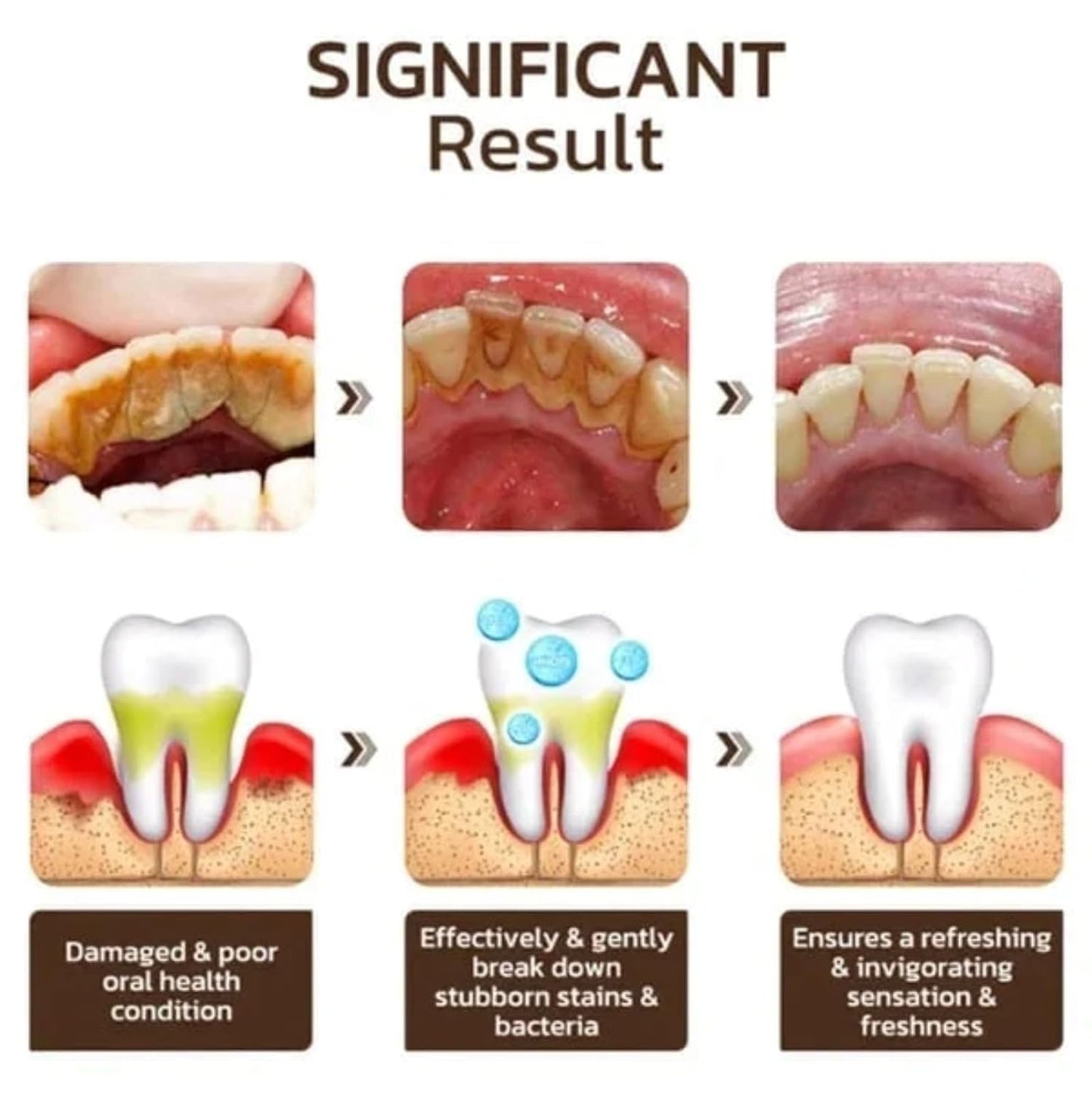 Probiotic Whitening Toothpaste