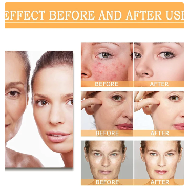 ORDINARY Solution for Blemishes, Acne, and Wrinkles, Toning Resurfacing Solution